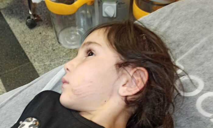 Küçük kız sevmek istediği sokak köpeğinin saldırısına uğradı!.