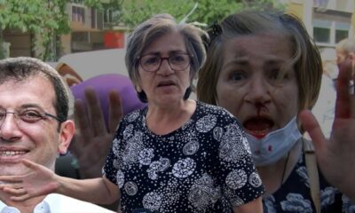 Kolu kırılan kadının İmamoğlu isyanı! “Başa getirelim ne olacak dedik, bizi ne güzel tokatladı!.”