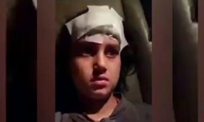 Altındağ’da yaralanan Suriyeli çocuk: “Beni öldürmeyin!.” (video haber)