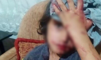 Ankara’daki saldırıda yaralanan Suriyeli küçük çocuk tedavi altına alındı!.