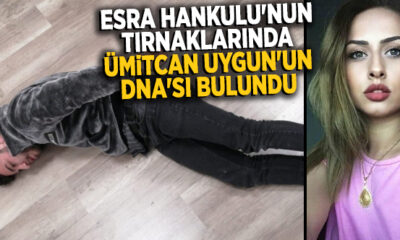 Esra Hankulu’nun tırnaklarında, Ümitcan Uygun’un DNA’sı tespit edildi!.