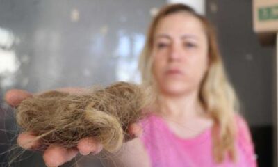 Gaziantep’te hemşireye çirkin saldırı! Darp edip, saçlarını yoldular!.