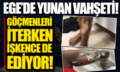 Göçmenlere Yunan mezalimi! Geri iterken işkence ediyorlar, vücutlarında kimyasala bağlı yanıklar var!.