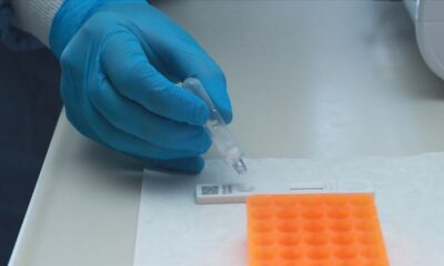 Almanya’da, coronavirüs testleri ücretli oldu!.