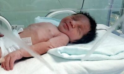 Toprağa gömülü halde bulunan bebekten sevindiren haber..