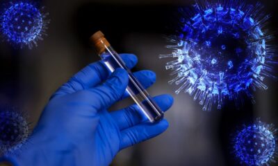 3 Kasım coronavirüs raporu açıklandı!.