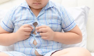 Coronavirüs, kilolu çocuklarda ağır seyrediyor!.