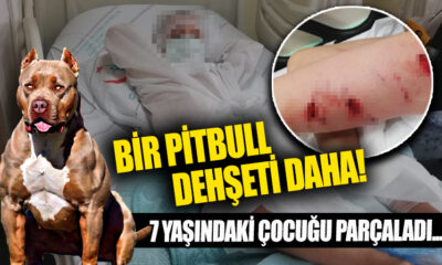 Bir pitbull dehşeti de İzmir’den! 7 yaşındaki çocuğu parçaladı!.