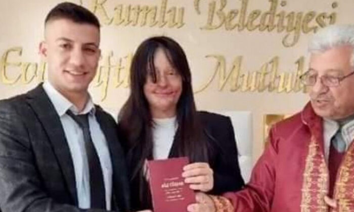 Berfin Özek, yüzünü kezzapla yakan Ozan Çeltik’le evlendi!.