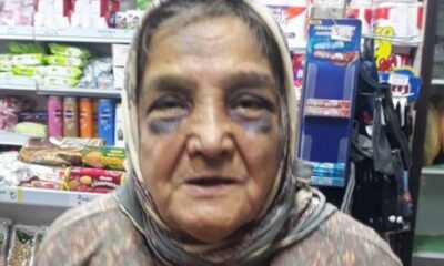 Eşi tarafından dövülen 73 yaşındaki kadın, konukevine yerleştirildi!.