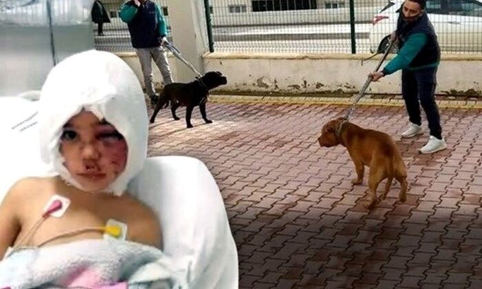 Pitbull saldırısına uğrayan Asiye’ye, doku nakli yapılacak!.