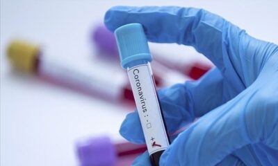 31 Mart Covid-19 verileri açıklandı!.