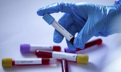 25 Nisan Covid-19 raporu açıklandı!.