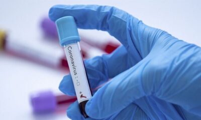 21 Nisan coronavirüs verileri açıklandı!.