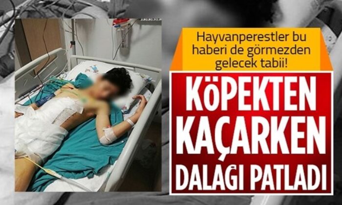 Çorum’da köpekten kaçmaya çalışan çocuğun dalağı parçalandı!.