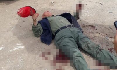 Sakarya’da yaşlı adam sokak köpeklerinin saldırısına uğradı!.