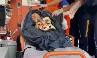Bursa’da çöp evden çıkan Cem Muhammet’in sağlık durumuyla ilgili yeni açıklama..