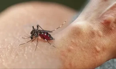 Yunanistan alarmda! 11 kişi öldü, 123 kişi enfekte oldu!.