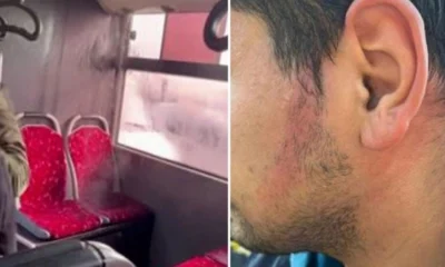 Ümraniye’de İETT otobüsünün klima borusu patladı, yolcunun üzerine kaynar su döküldü!.