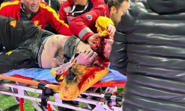 İzmir’de taraftarların yüzüne fişek atan yakalandı,13 kişi gözetim altında..