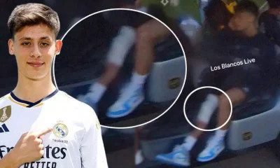 Arda Güler, Real Madrid’de sakatlandı!.