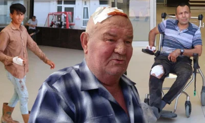 Bayram bilançosu! 30 binden fazla acemi kasap hastanelik oldu!.