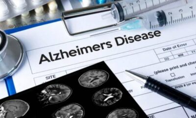 Alzheimer aşısında yeni gelişme! İlk deneyin sonuçları paylaşıldı!.