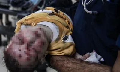 Kahpe İsrail’in kan donduran katliamları devam ediyor!.