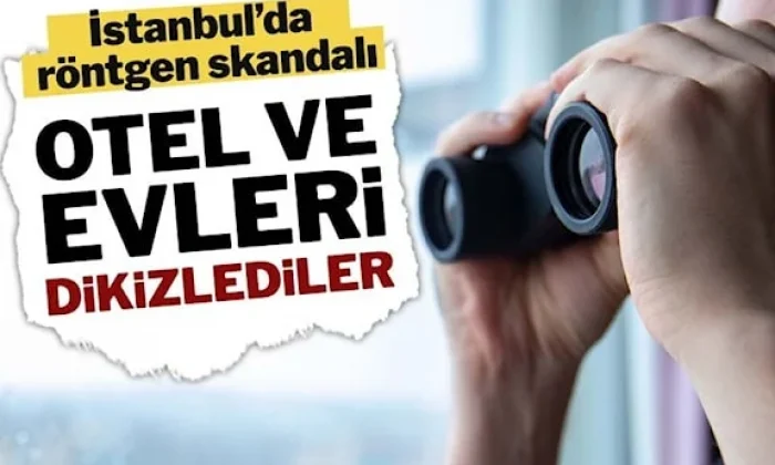 İBB’de röntgen skandalı!.