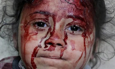 5 ayda Gazze’de katledilen çocuk sayısı 12 bini geçti!.
