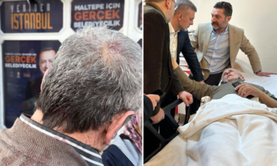 Broşür dağıtan 72 yaşındaki AK Partiliye saldıran alçaklar CHP’li çıktı!.