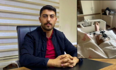 AKP’li vekilin kardeşi gazeteci kurşunladı!.