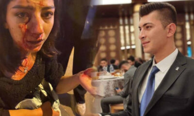 Akp’li Başkan genç kızın burnunu kırıp hastanelik etti!.