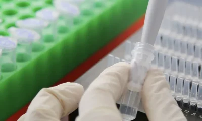 Rusya kanser aşısının hazır olduğunu ve ücretsiz uygulanacağını açıkladı..